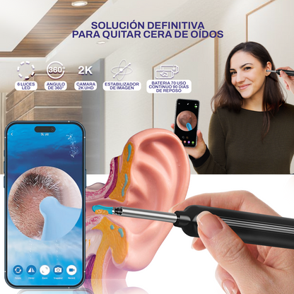 SUPER OTOSCOPIO CON CÁMARA