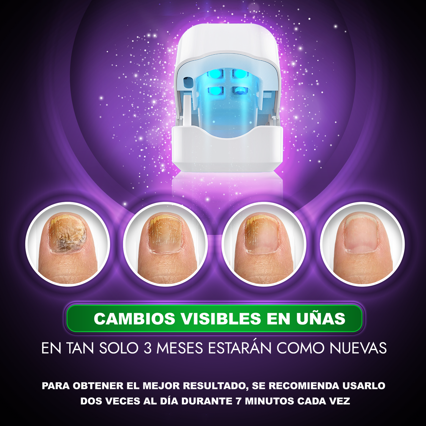 LASER UÑAS (PACK DE 2 UNIDADES AL 50% DESCUENTO=32,99€)