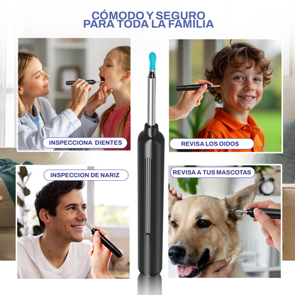 SUPER OTOSCOPIO CON CÁMARA